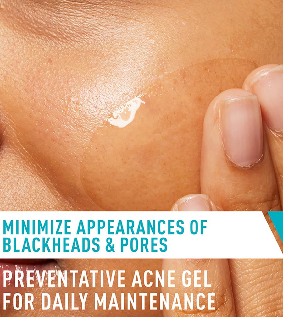 Acne Control Gel